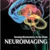 Neuroimaging: Sensing Biochemistry in the Brain (EPUB)