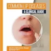 Common Lip Diseases: A Clinical Guide (EPUB)