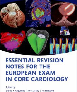 Essential Revision notes for the European Exam in Core Cardiology, 2nd Edition (EPUB)