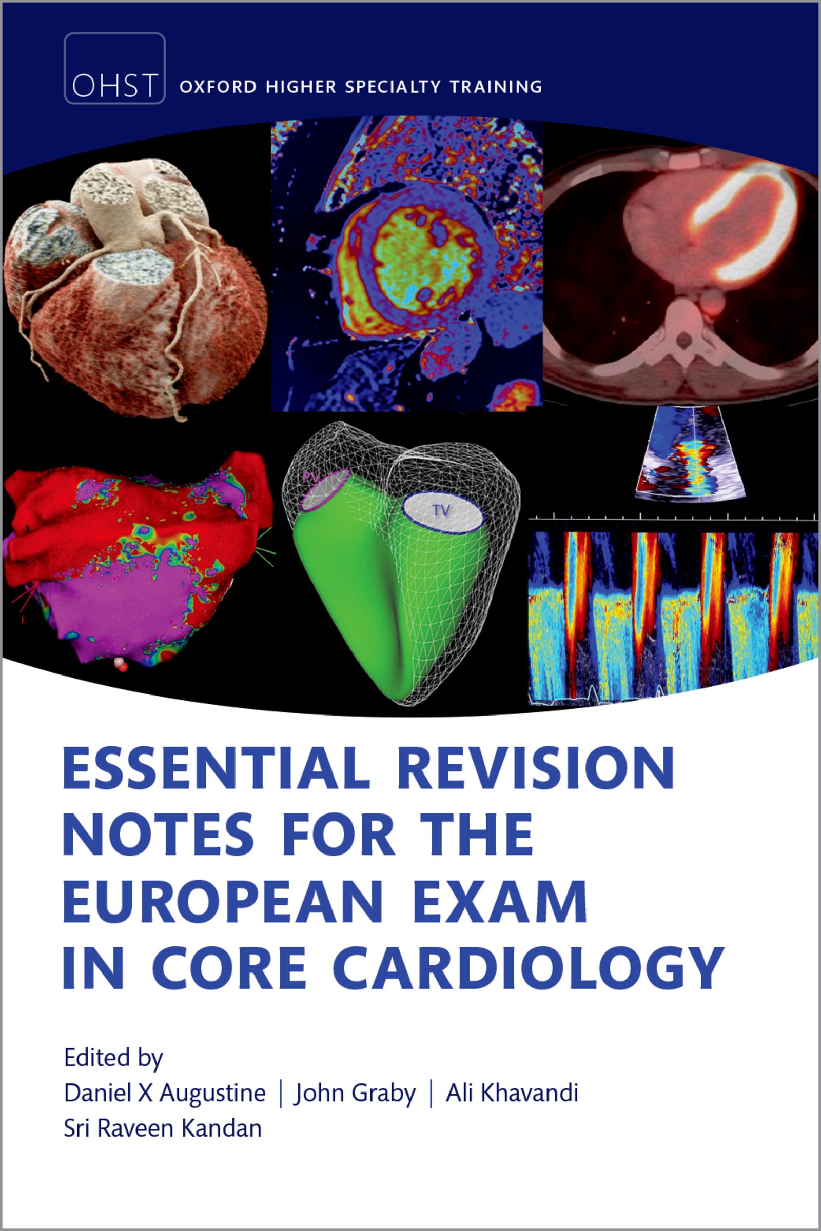 Essential Revision notes for the European Exam in Core Cardiology, 2nd Edition (EPUB) Essential Revision notes for the European Exam in Core Cardiology, 2nd Edition (EPUB)