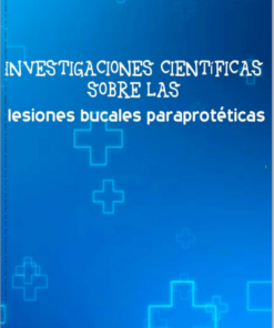 Investigaciones científicas sobre las lesiones bucales paraprotéticas (PDF)