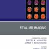 Fetal MRI, An Issue of Magnetic Resonance Imaging Clinics of North America (True PDF)