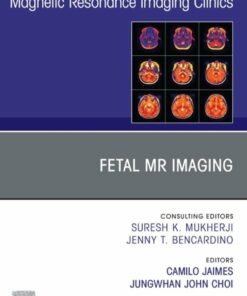 Fetal MRI, An Issue of Magnetic Resonance Imaging Clinics of North America (True PDF)