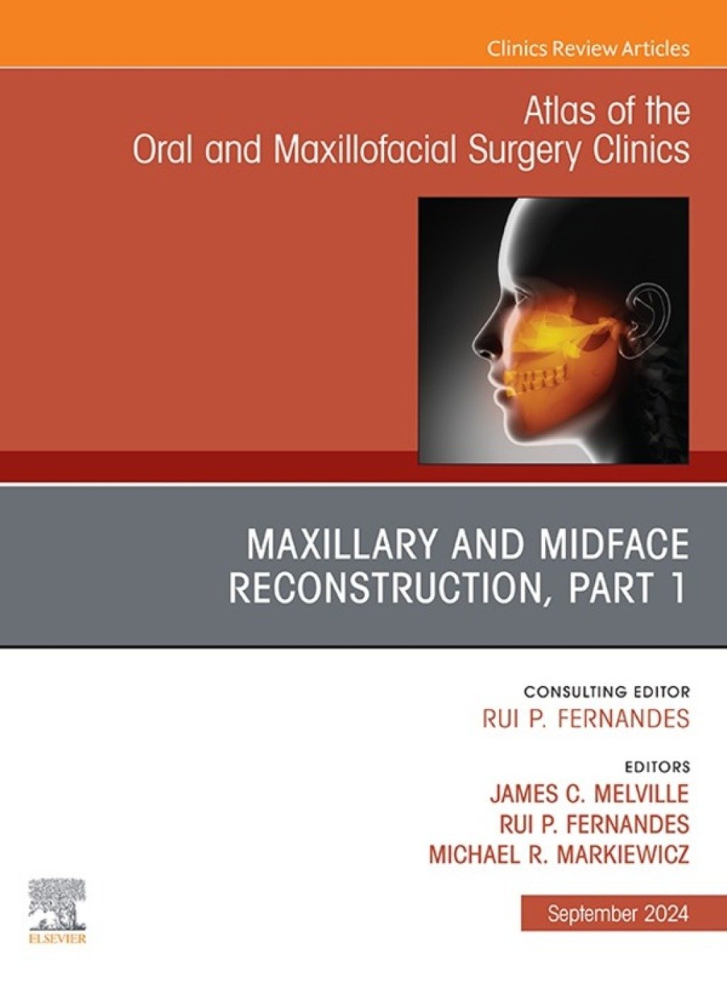 Maxillary and Midface Reconstruction, Part 1, An Issue of Atlas of the Oral & Maxillofacial Surgery Clinics (True PDF ) Maxillary and Midface Reconstruction, Part 1, An Issue of Atlas of the Oral & Maxillofacial Surgery Clinics (True PDF )