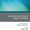 Early and Late Presentation of Physical Changes of Puberty: Precocious and Delayed Puberty Revisited, An Issue of Endocrinology and Metabolism Clinics of North America (True PDF)
