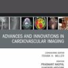 Advances and Innovations in Cardiovascular Imaging, An Issue of Radiologic Clinics of North America (True PDF )