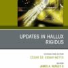 Updates in Hallux Rigidus, An issue of Foot and Ankle Clinics of North America (True PDF )