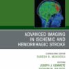 Advanced Imaging in Ischemic and Hemorrhagic Stroke, An Issue of Neuroimaging Clinics of North America (True PDF )