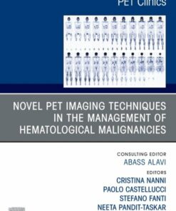 Novel PET Imaging Techniques in the Management of Hematologic Malignancies, An Issue of PET Clinics (True PDF)