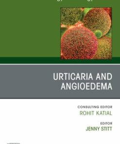 Urticaria and Angioedema, An Issue of Immunology and Allergy Clinics of North America (True PDF )