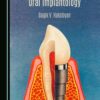 Surgical and Prosthetic Oral Implantology (PDF)