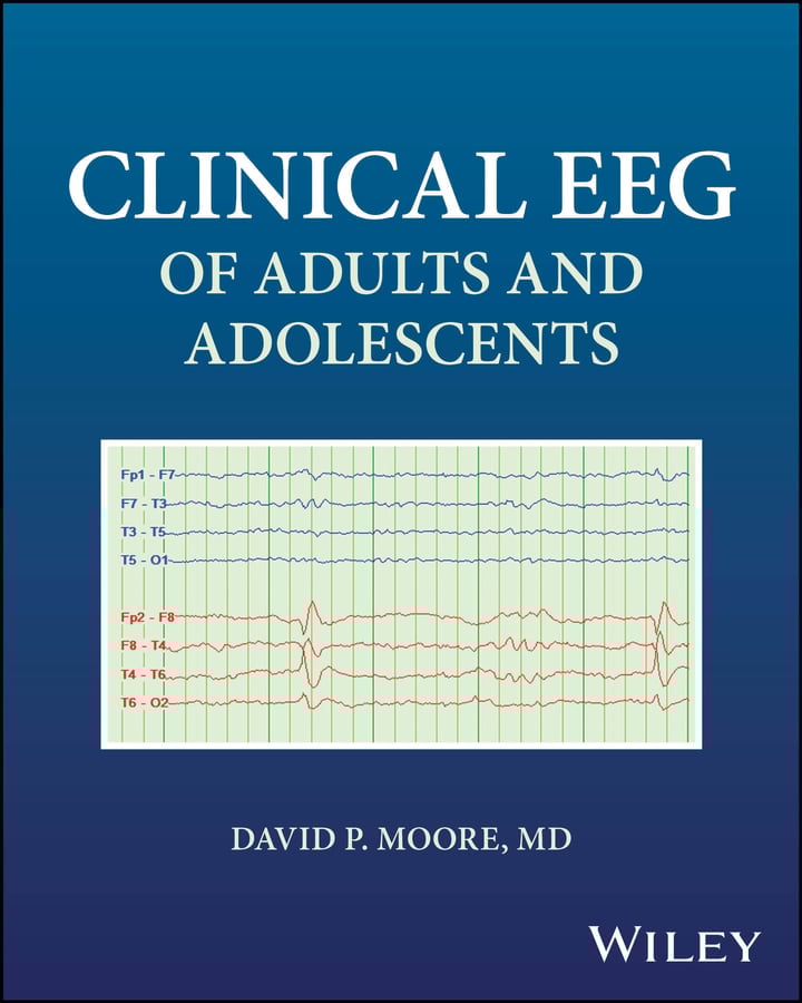 Clinical EEG of Adults and Adolescents (PDF) Clinical EEG of Adults and Adolescents (PDF)