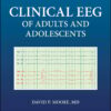Clinical EEG of Adults and Adolescents (EPUB)