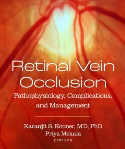 Retinal Vein Occlusion: Pathophysiology, Complications, and Management (PDF)