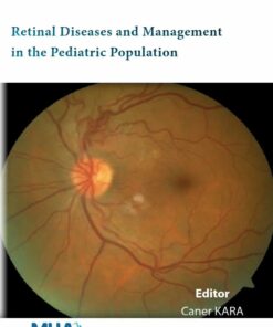 Retinal Diseases and Management in the Pediatric Population (PDF)
