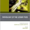Pathology of the Lesser Toes, An issue of Foot and Ankle Clinics of North America (The Clinics: Orthopedics, Volume 29-4) (True PDF from Publisher)