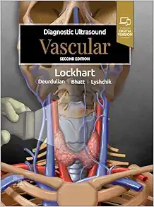 Diagnostic Ultrasound: Vascular, 2nd edition (EPUB) Diagnostic Ultrasound: Vascular, 2nd edition (EPUB)