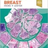 Diagnostic Pathology: Breast, 4th edition (EPUB) Diagnostic Pathology: Breast, 4th edition (EPUB)