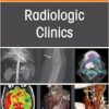 Pearls and Pitfalls in Thoracic Disease Imaging, An Issue of Radiologic Clinics of North America (Volume 63-4) (The Clinics: Radiology, Volume 63-4) (EPUB)