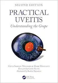 Practical Uveitis, 2nd edition (PDF) Practical Uveitis, 2nd edition (PDF)