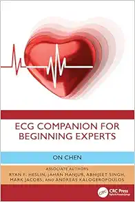 ECG Companion For Beginning Experts (PDF) ECG Companion For Beginning Experts (PDF)