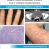 Pediatric Collections: Infectious Disease Cases: Part 2: Indolent Head Scratchers (PDF) Pediatric Collections: Infectious Disease Cases: Part 2: Indolent Head Scratchers (PDF)