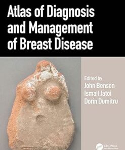 Atlas of Diagnosis and Management of Breast Disease (PDF)