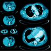 UCSF Abdominal and Thoracic Imaging 2025 (Videos + Slides PDFs) UCSF Abdominal and Thoracic Imaging 2025 (Videos + Slides PDFs)