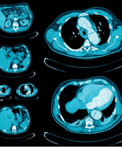 UCSF Abdominal and Thoracic Imaging 2025 (Videos + Slides PDFs)