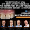 OHI-S – Ceramic Restorations: Veneers, Inlays, Crowns