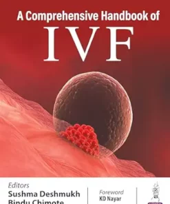 A Comprehensive Handbook of IVF (PDF)