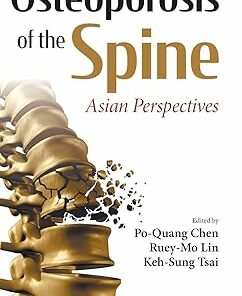Osteoporosis of the Spine: Asian Perspectives (EPUB)
