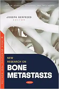 New Research on Bone Metastasis (PDF) New Research on Bone Metastasis (PDF)