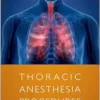 Thoracic Anesthesia Procedures (EPUB) Thoracic Anesthesia Procedures (EPUB)