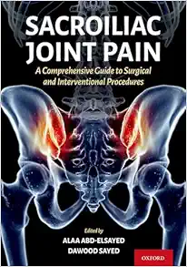 Sacroiliac Joint Pain: A Comprehensive Guide to Interventional and Surgical Procedures (EPUB) Sacroiliac Joint Pain: A Comprehensive Guide to Interventional and Surgical Procedures (EPUB)