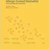Allergic Contact Dermatitis: Chemical and Metabolic Mechanisms (PDF) Allergic Contact Dermatitis: Chemical and Metabolic Mechanisms (PDF)