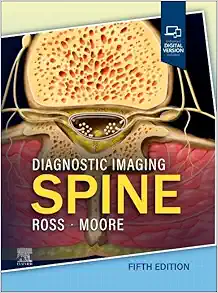Diagnostic Imaging: Spine, 5th edition (PDF) Diagnostic Imaging: Spine, 5th edition (PDF)