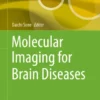Molecular Imaging for Brain Diseases :