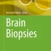 Brain Biopsies :