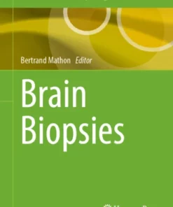 Brain Biopsies :