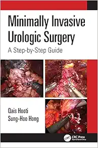 Minimally Invasive Urologic Surgery: A Step-by-Step Guide (EPUB)