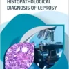Histopathological Diagnosis Of Leprosy (EPUB)