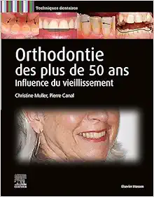 Orthodontie des plus de 50 ans: Influence du vieillissement (PDF) Orthodontie des plus de 50 ans: Influence du vieillissement (PDF)