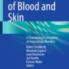 Diseases of Blood and Skin : A Dermatologic Correlation of Hematologic Disorders