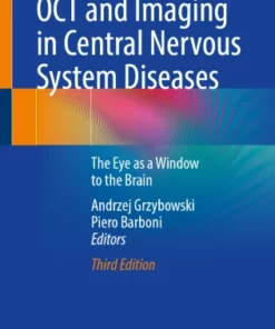 OCT and Imaging in Central Nervous System Diseases : The Eye as a Window to the Brain
