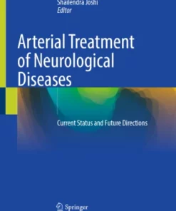Arterial Treatment of Neurological Diseases : Current Status and Future Directions