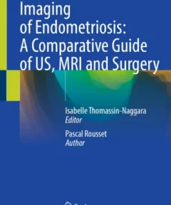 Imaging of Endometriosis: A Comparative Guide of US, MRI and Surgery :