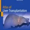 Atlas of Liver Transplantation :