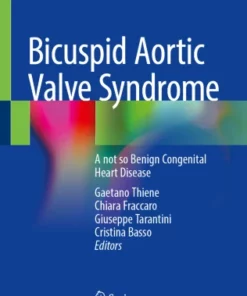 Bicuspid Aortic Valve Syndrome : A not so Benign Congenital Heart Disease