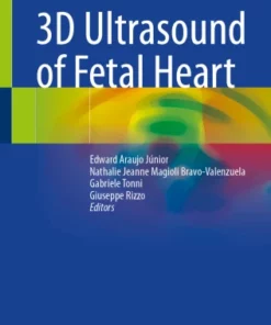 3D Ultrasound of Fetal Heart :
